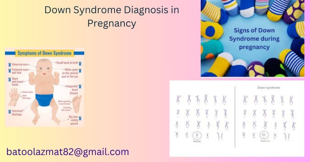 Down Syndrome Diagnosis in Pregnancy: Tests, Accuracy & What to Expect